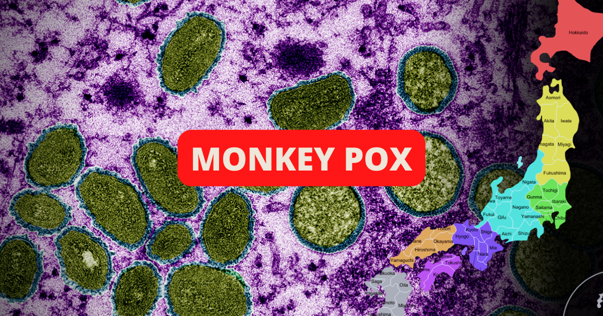 Japan confirms its first Monkeypox case